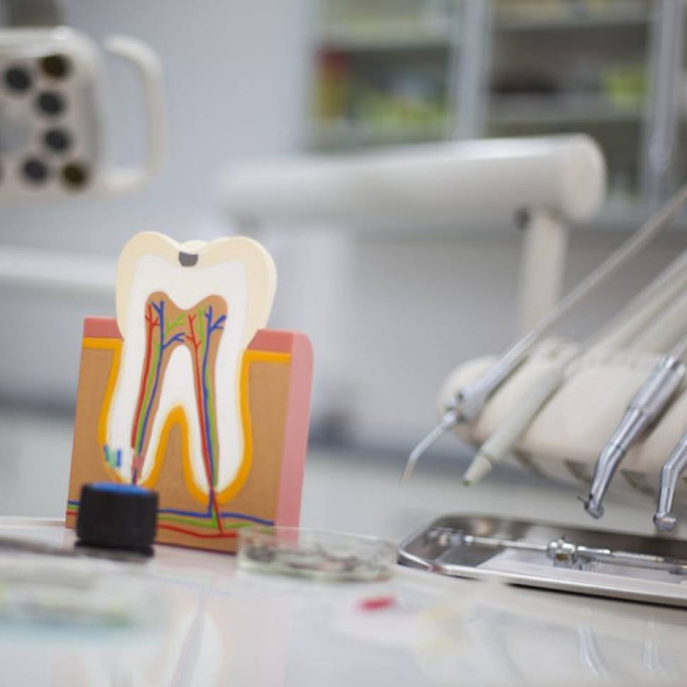 leczenie kanałowe endodontyczne zęba